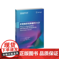 肝胆胰恶性肿瘤PET/CT