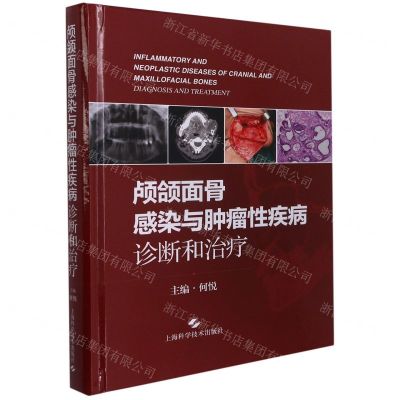 [N]颅颌面骨感染与肿瘤性疾病诊断和治疗(精)-9787547854884