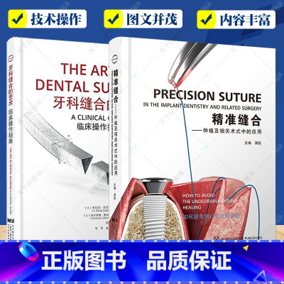 [正版]精准缝合 种植及相关术式中的应用 满毅+牙科缝合的艺术 临床操作指南 牙医修复嵌体正畸口腔科学种植牙体牙髓之路
