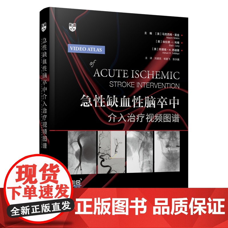 正版 急性缺血性脑卒中介入治疗视频图谱 配套视频急性缺血性脑卒中血管内治疗技术 近端 远端和串联闭塞的抽吸及支架取栓