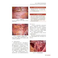 实用妇科微创手术图谱:机器人与多孔单孔腹腔镜(原书第2版)