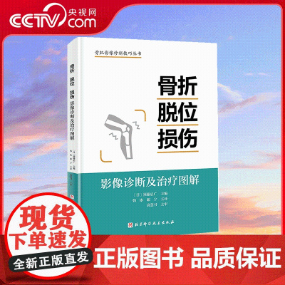 [央视网]骨折脱位损伤 影像诊断及治疗图解 详细分型高清图片视频演示 介绍骨折脱位和损伤的基本知识 检查与诊断方法和治疗
