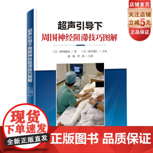 超声引导下周围神经阻滞技巧图解 影响医学 现代医学 北京科学技术