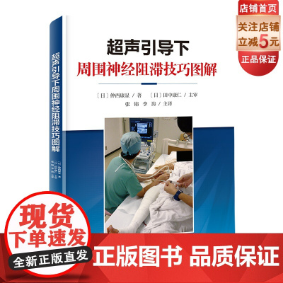 超声引导下周围神经阻滞技巧图解 影响医学 现代医学 北京科学技术