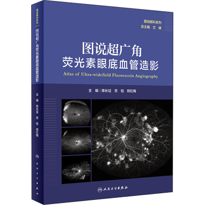 [M]图说超广角荧光素眼底血管造影-9787117314510