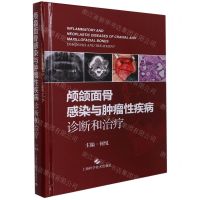 [N]颅颌面骨感染与肿瘤性疾病诊断和治疗(精)-9787547854884