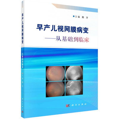 早产儿视网膜病变——从基础到临床