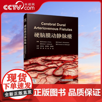 [央视网]硬脑膜动静脉瘘 Bradley A. Gross 郭庚 9787523604724 ZK