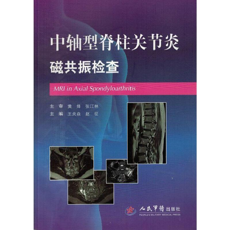 正版新书]中轴型脊柱关节炎磁共振检查王炎焱 赵征9787509185360