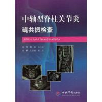 正版新书]中轴型脊柱关节炎磁共振检查王炎焱 赵征9787509185360