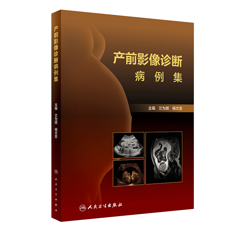 音像产前影像诊断病例集兰为顺,杨文忠