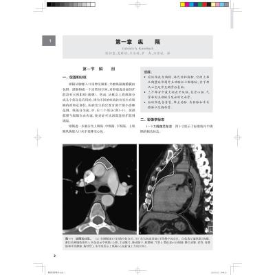 胸腹部影像学精要--影像解剖、影像表现、诊断与鉴别诊断
