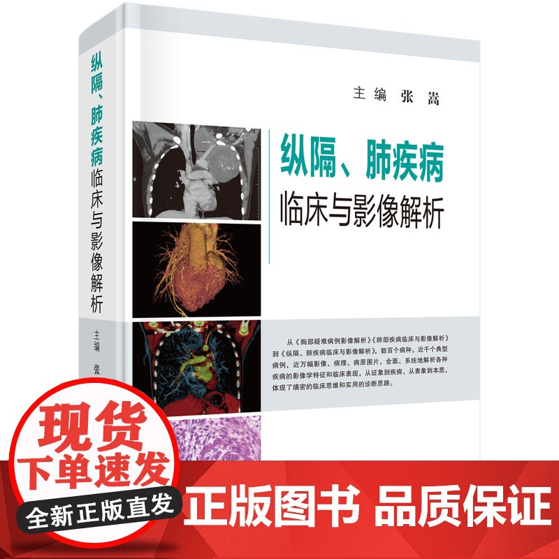 纵隔、肺疾病临床与影像解析张嵩科学出版社9787030594679医学卫生/医学其它