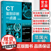 CT鉴别诊断一点通 第四版 影像鉴别诊断一目了然系列 常见病 少见病 一病配多图 病灶指示箭头 表格鉴别要点 影像科医生