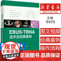 EBUSTBNA技术及经典案例 李时悦编 超声内镜引导下经支气管针吸活检术操作原理相关基础知识标准流程临床应用 上海科学
