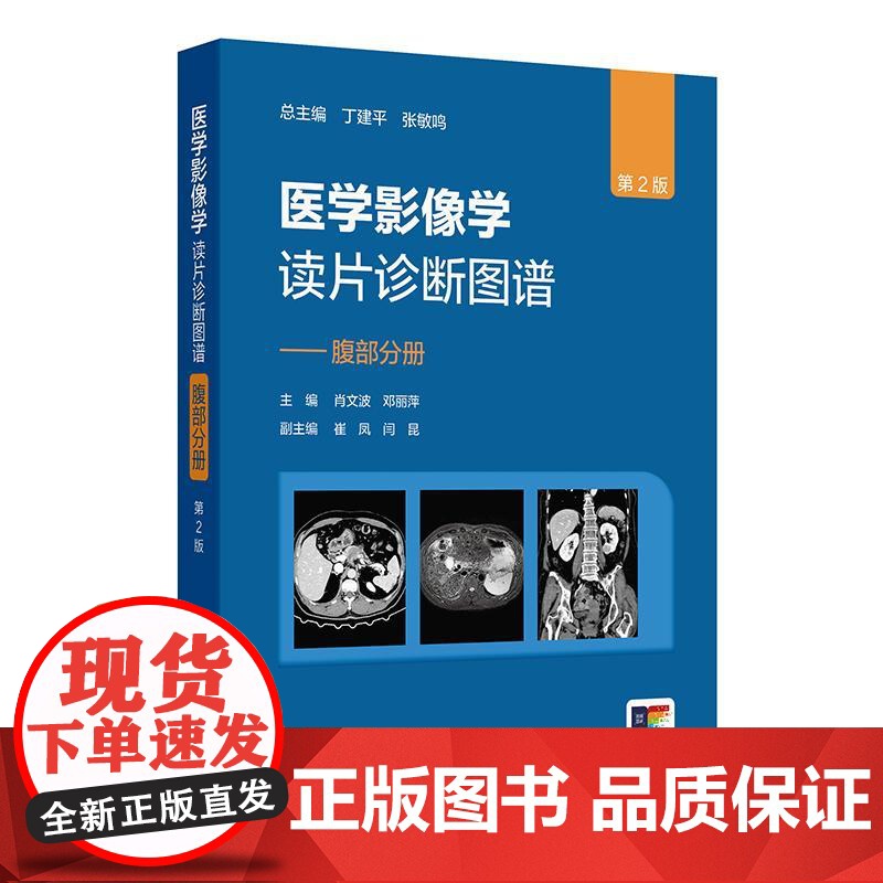 医学影像学读片诊断图谱——腹部分册(第2版)