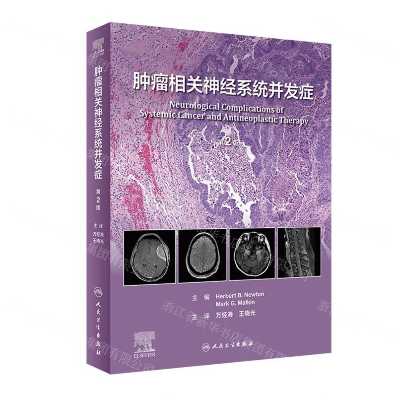 [N]肿瘤相关神经系统并发症(第2版)(精)-9787117347471