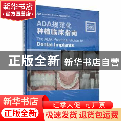 正版 ADA规范化种植临床指南