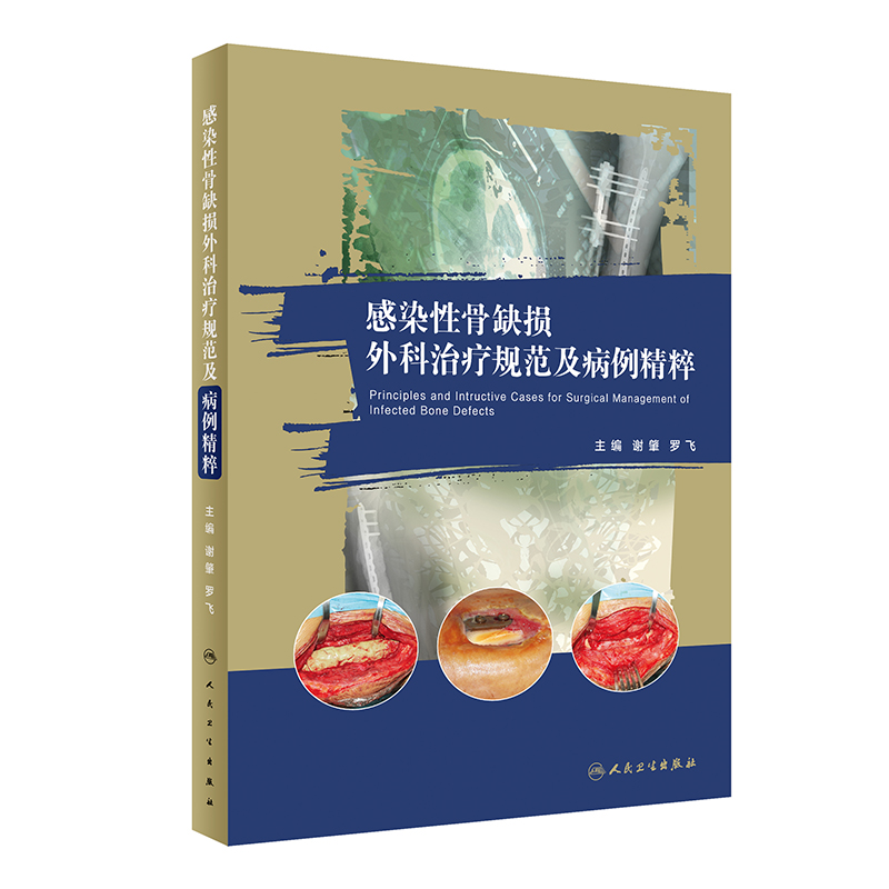 音像感染骨缺损外科治疗规范及病例精粹谢肇,罗飞