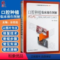 [正版]口腔种植临床操作图解 口腔临床操作技术丛书 谷志远主编 人民卫生出版社9787117129831