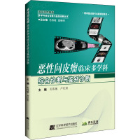 恶性间皮瘤临床多学科综合诊断与鉴别诊断