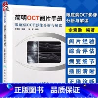 [正版] 简明OCT阅片手册眼底病OCT影像分析与解读 俞素勤 编著 人民卫生出版社 眼科医生的口袋书 眼科学 解读视