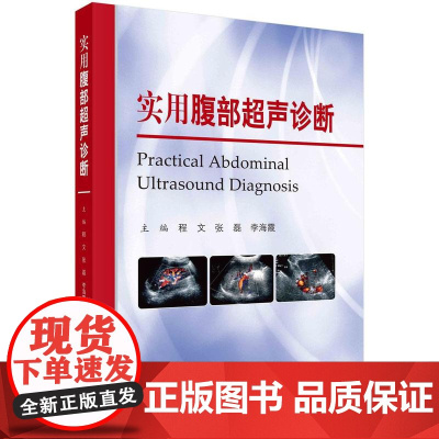 [按需印刷]实用腹部超声诊断