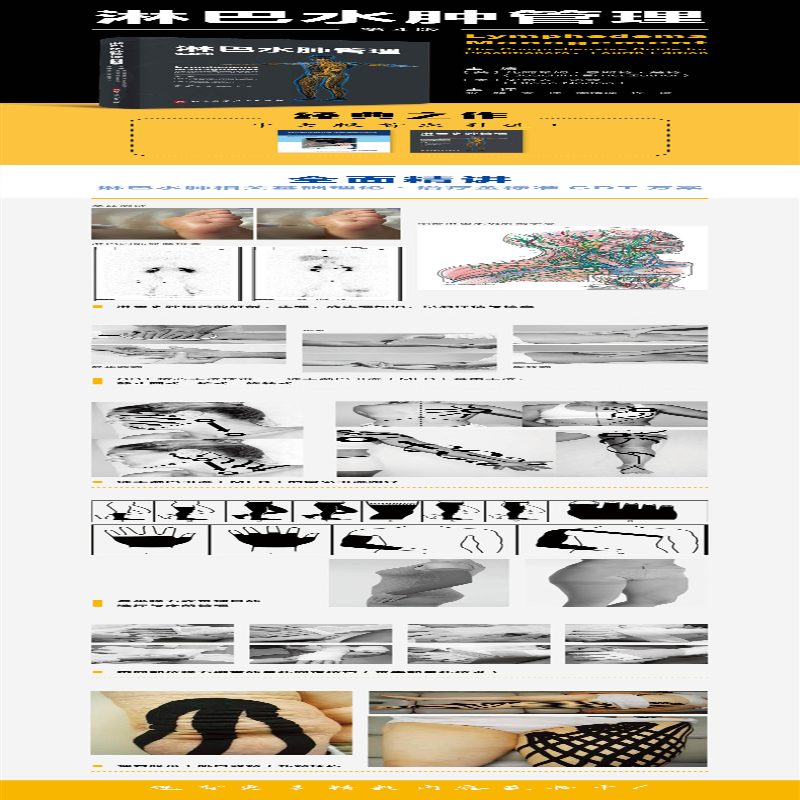 [M]淋巴水肿管理(第4版)-9787571405687