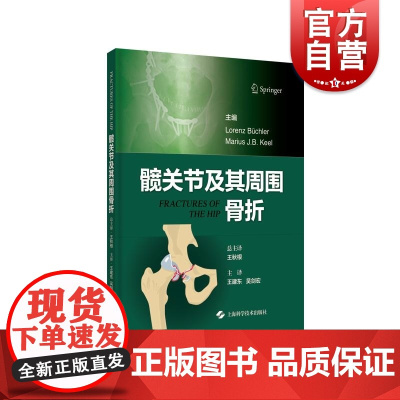 髋关节及其周围骨折 上海科学技术出版社