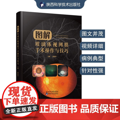 图解玻璃体视网膜手术操作与技巧 雷春灵青少年玻璃体视网膜疾病视觉康复眼保健改善保护视力指导临床眼科验光眼外科手术医学书籍