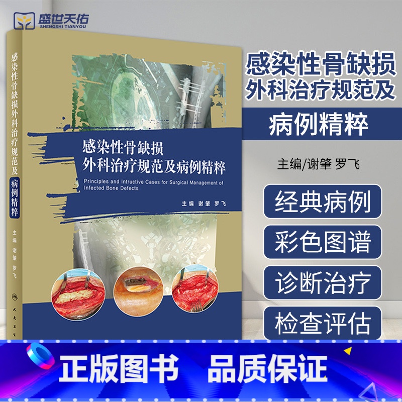 [正版]感染性骨缺损外科治疗规范及病例精粹 谢肇 罗飞 骨缺损缺失骨感染控制死腔处理治疗病例病变骨科学手术外科学修复实