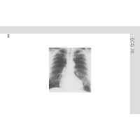 [M]轻松解读心电图(第5版)-9787565926259