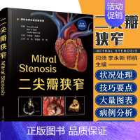 [正版] Mitral Stenosis 二尖瓣狭窄 附视频 闫炀 李永新 师桃 二尖瓣疾病心内科速查手册风湿性心脏病学