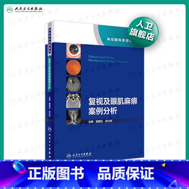 [正版]复视及眼肌麻痹案例分析神经眼科实用系列 田国红孙兴怀 眼科学视神经疾病看图识病疑难杂症罕见病例人民卫生出版社眼