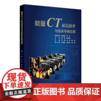 能量CT前沿技术与临床专病应用常规CT的局限性和能量CT成像原理球管技术月强姚晋胡娜人民卫生出版社影像医学诊断