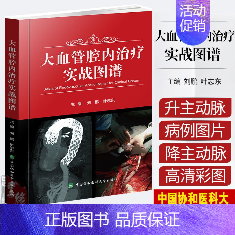 [正版]9月新版 大血管腔内治疗实战图谱刘鹏叶志东临床医生医学类本专业研究生参考学习医学外科学主动脉临床中国协和医科大学