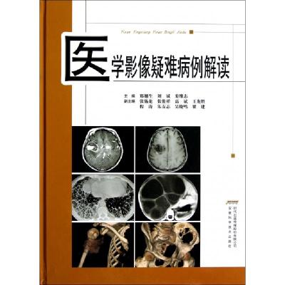 正版新书]医学影像疑难病例解读(精)郑穗生//刘斌//栾维志978753