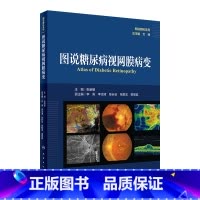 图说糖尿病视网膜病变(图说眼科系列) 2024年8月参考书 [正版]图说糖尿病视网膜病变(图说眼科系列) 2024年8月