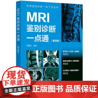 影像鉴别诊断一目了然系列 MRI鉴别诊断一点通 第四版 常见病少见病 一病配多图 病灶指示箭头 表格鉴别要点 影像科医生