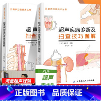 [正版]超声疾病诊断及扫查技巧图解+超声解剖及扫查技巧图解书籍正常值测量备忘录技术入门b超血管肌骨心超笔记腹部精细讲解心