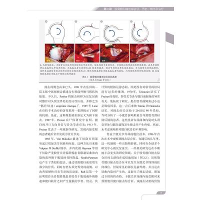 现代髋关节保护:病理生理学和外科治疗的新见解