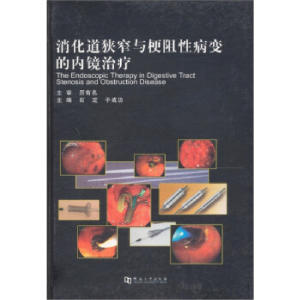 正版新书]消化道狭窄与梗阻性病变的内镜治疗石定、于成功978781
