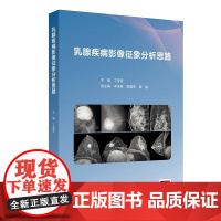 乳腺疾病影像征象分析思路 丁莹莹编 本书是以乳腺常见影像征象为出发点 深入探讨同影异病的征象在临床实践中的诊断及鉴别诊断